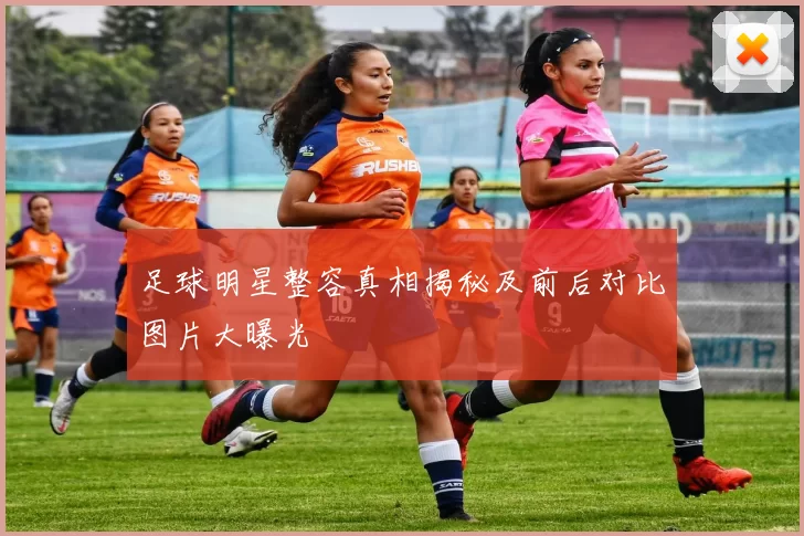 足球明星整容真相揭秘及前后对比图片大曝光